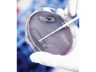 AXIMA-iD Plus Microorganism Analysis