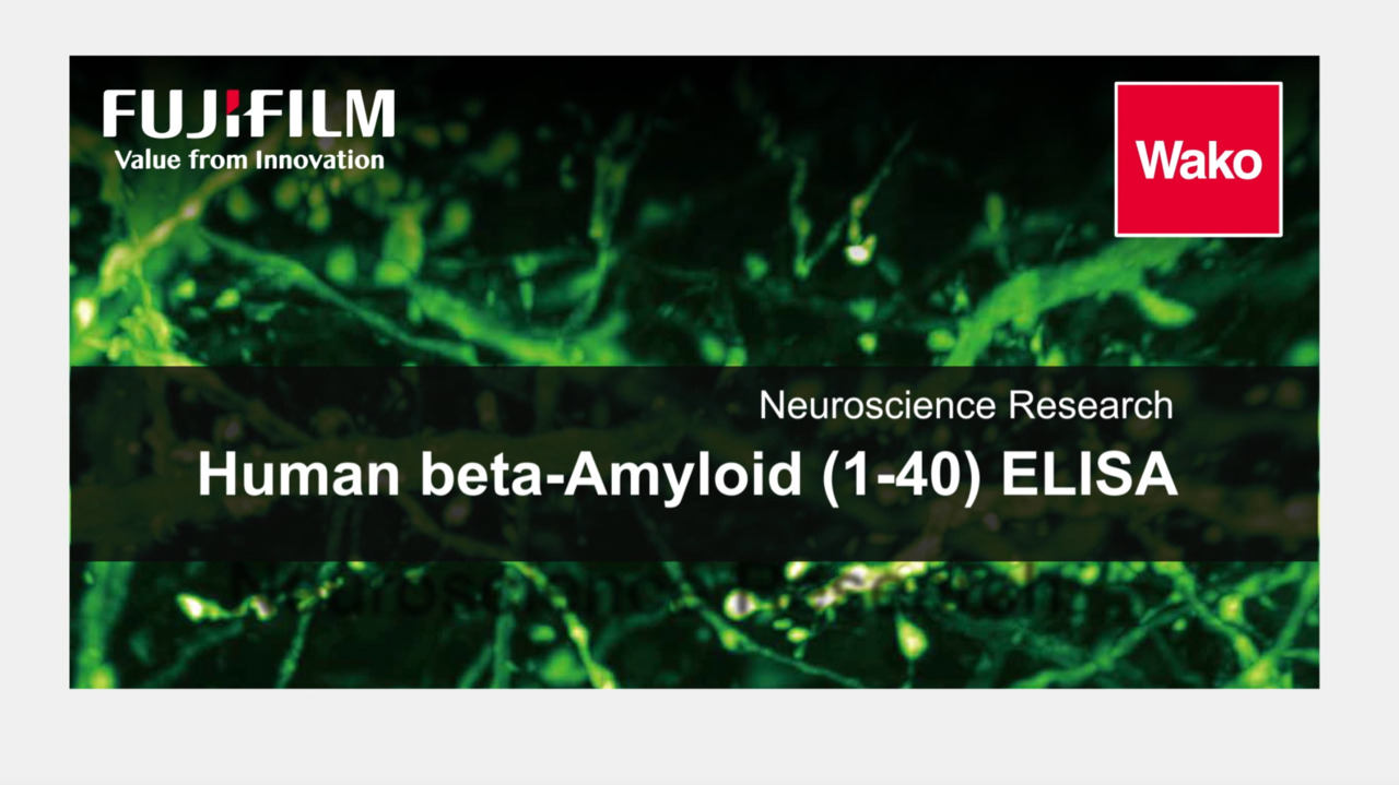 Human beta-Amyloid (1-40) ELISA
