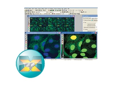 MetaXpress High Content Image Acquisition & Analysis Software