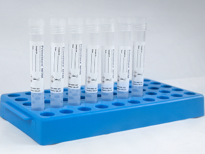 PrimeStore® MTM: Transport media for infectious diseases